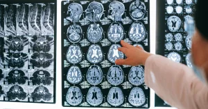 Brain During a Breakup